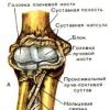 Fracturas diafisarias de ambos huesos del antebrazo Fractura diafisaria de ambos huesos del antebrazo escayola